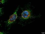 Mouse, IgG (H+L) SRM Secondary Antibody in Immunocytochemistry (ICC/IF)