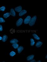 Mouse, IgG (H+L) SRM Secondary Antibody in Immunocytochemistry (ICC/IF)