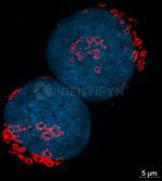 Rabbit IgG, (H+L) SRM Secondary Antibody in Immunocytochemistry (ICC/IF)