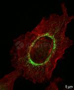 Rabbit IgG, (H+L) SRM Secondary Antibody in Immunocytochemistry (ICC/IF)