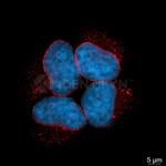 Mouse, IgG (H+L), (Subclasses 1+2a+2b+3), Fcy Fragment Specific SRM Secondary Antibody in Immunocytochemistry (ICC/IF)