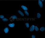 Mouse, IgG (H+L), (Subclasses 1+2a+2b+3), Fcy Fragment Specific SRM Secondary Antibody in Immunocytochemistry (ICC/IF)