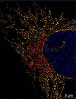 Rabbit IgG, (H+L) SRM Secondary Antibody in Immunocytochemistry (ICC/IF)