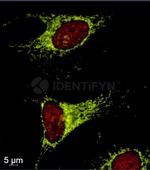 Human IgG, (H+L) SRM Secondary Antibody in Immunocytochemistry (ICC/IF)