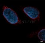 Mouse, IgG (H+L) SRM Secondary Antibody in Immunocytochemistry (ICC/IF)