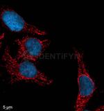 Rabbit IgG, (H+L) SRM Secondary Antibody in Immunocytochemistry (ICC/IF)