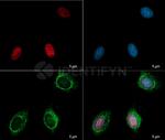 Human, IgG (H+L) SRM Secondary Antibody in Immunocytochemistry (ICC/IF)