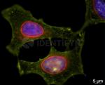 Mouse IgG, (H+L) SRM Secondary Antibody in Immunocytochemistry (ICC/IF)