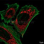 Mouse IgG, (H+L) SRM Secondary Antibody in Immunocytochemistry (ICC/IF)