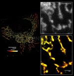 Mouse, IgG (H+L), (Subclasses 1+2a+2b+3), Fcy Fragment Specific SRM Secondary Antibody in Immunocytochemistry (ICC/IF)