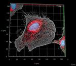 Mouse, IgG (H+L) SRM Secondary Antibody in Immunocytochemistry (ICC/IF)
