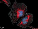 Mouse, IgG (H+L) SRM Secondary Antibody in Immunocytochemistry (ICC/IF)