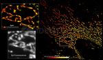 Mouse, IgG (H+L) SRM Secondary Antibody in Immunocytochemistry (ICC/IF)
