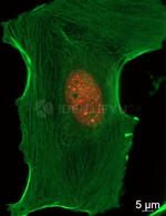Human, IgG (H+L) SRM Secondary Antibody in Immunocytochemistry (ICC/IF)