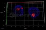 Rabbit IgG, (H+L) SRM Secondary Antibody in Immunocytochemistry (ICC/IF)