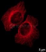 Mouse IgG, (H+L) SRM Secondary Antibody in Immunocytochemistry (ICC/IF)