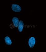 Mouse IgG, (H+L) SRM Secondary Antibody in Immunocytochemistry (ICC/IF)