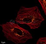Rabbit IgG, (H+L) SRM Secondary Antibody in Immunocytochemistry (ICC/IF)