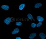 Mouse, IgG (H+L), (Subclasses 1+2a+2b+3), Fcy Fragment Specific SRM Secondary Antibody in Immunocytochemistry (ICC/IF)