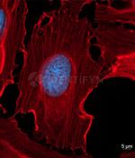 Rabbit IgG, (H+L) SRM Secondary Antibody in Immunocytochemistry (ICC/IF)