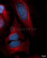 Mouse IgG, (H+L) SRM Secondary Antibody in Immunocytochemistry (ICC/IF)