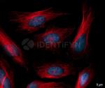 Rabbit IgG, (H+L) SRM Secondary Antibody in Immunocytochemistry (ICC/IF)