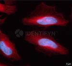 Mouse IgG, (H+L) SRM Secondary Antibody in Immunocytochemistry (ICC/IF)
