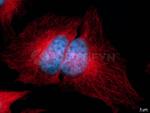 Mouse IgG, (H+L) SRM Secondary Antibody in Immunocytochemistry (ICC/IF)
