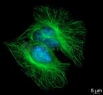 Rat IgG, (H+L) SRM Secondary Antibody in Immunocytochemistry (ICC/IF)