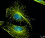 Rat IgG, (H+L) SRM Secondary Antibody in Immunocytochemistry (ICC/IF)