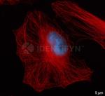 Rat IgG, (H+L) SRM Secondary Antibody in Immunocytochemistry (ICC/IF)