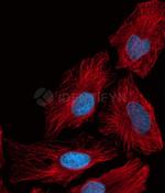 Rat IgG, (H+L) SRM Secondary Antibody in Immunocytochemistry (ICC/IF)