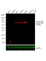 Human IgM Cross-Adsorbed Secondary Antibody in Western Blot (WB)