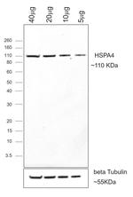Human IgG (H+L) Secondary Antibody in Western Blot (WB)