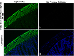 Mouse IgG2a Secondary Antibody in Immunohistochemistry (Paraffin) (IHC (P))