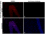 Mouse IgG2a Secondary Antibody in Immunohistochemistry (Paraffin) (IHC (P))