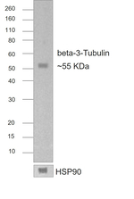 Mouse IgG2a Secondary Antibody in Western Blot (WB)