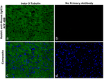 Mouse IgG2a Secondary Antibody in Immunohistochemistry (Paraffin) (IHC (P))