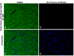 Mouse IgG2b Secondary Antibody in Immunohistochemistry (Paraffin) (IHC (P))