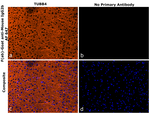 Mouse IgG2b Secondary Antibody in Immunohistochemistry (Paraffin) (IHC (P))