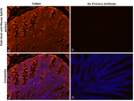 Mouse IgG2b Secondary Antibody in Immunohistochemistry (Paraffin) (IHC (P))