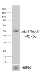 Mouse IgG1 Secondary Antibody in Western Blot (WB)