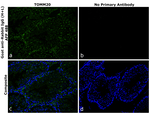 Rabbit IgG (H+L) Secondary Antibody in Immunohistochemistry (Paraffin) (IHC (P))