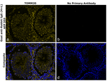 Rabbit IgG (H+L) Secondary Antibody in Immunohistochemistry (Paraffin) (IHC (P))