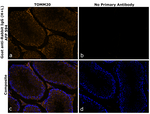 Rabbit IgG (H+L) Secondary Antibody in Immunohistochemistry (Paraffin) (IHC (P))
