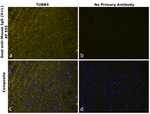 Mouse IgG (H+L) Secondary Antibody in Immunohistochemistry (Paraffin) (IHC (P))