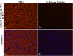 Mouse IgG (H+L) Secondary Antibody in Immunohistochemistry (Paraffin) (IHC (P))