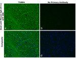Mouse IgG (H+L) Secondary Antibody in Immunohistochemistry (Paraffin) (IHC (P))