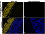 Mouse IgG (H+L) Secondary Antibody in Immunohistochemistry (Paraffin) (IHC (P))