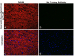 Mouse IgG (H+L) Secondary Antibody in Immunohistochemistry (Paraffin) (IHC (P))